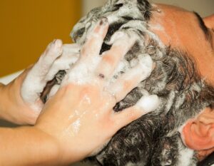 La dermatite séborrhéique